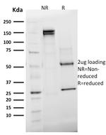 Emerin Antibody in SDS-PAGE (SDS-PAGE)