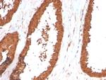 TIGIT/VSTM3/VSIG9 (Immune Checkpoint for Cancer) Antibody in Immunohistochemistry (Paraffin) (IHC (P))