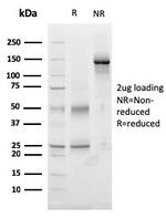 TIGIT/VSTM3/VSIG9 (Immune Checkpoint for Cancer) Antibody in SDS-PAGE (SDS-PAGE)