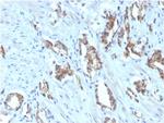 TIGIT/VSTM3/VSIG9 (Immune Checkpoint for Cancer) Antibody in Immunohistochemistry (Paraffin) (IHC (P))