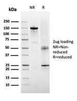 TIGIT/VSTM3/VSIG9 (Immune Checkpoint for Cancer) Antibody in SDS-PAGE (SDS-PAGE)