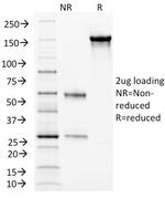 Endoglin/CD105 (Angiogenesis Marker) Antibody in SDS-PAGE (SDS-PAGE)