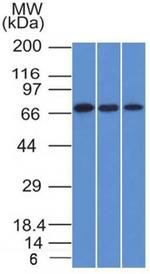 Endoglin/CD105 (Angiogenesis Marker) Antibody in Western Blot (WB)