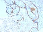 Endoglin/CD105 (Angiogenesis Marker) Antibody in Immunohistochemistry (Paraffin) (IHC (P))