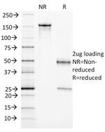 Endoglin/CD105 (Angiogenesis Marker) Antibody in SDS-PAGE (SDS-PAGE)