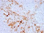 Endoglin/CD105 (Angiogenesis Marker) Antibody in Immunohistochemistry (Paraffin) (IHC (P))