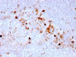 Endoglin/CD105 (Angiogenesis Marker) Antibody in Immunohistochemistry (Paraffin) (IHC (P))