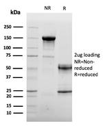 Endoglin/CD105 (Angiogenesis Marker) Antibody in SDS-PAGE (SDS-PAGE)