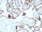 Endoglin/CD105 (Angiogenesis Marker) Antibody in Immunohistochemistry (Paraffin) (IHC (P))