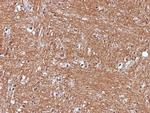 NSE gamma (Neuron Specific Enolase, gamma) Antibody in Immunohistochemistry (Paraffin) (IHC (P))