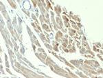 NSE gamma (Neuron Specific Enolase, gamma) Antibody in Immunohistochemistry (Paraffin) (IHC (P))