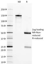 NSE gamma (Neuron Specific Enolase, gamma) Antibody in SDS-PAGE (SDS-PAGE)