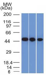 NSE gamma (Neuron Specific Enolase, gamma) Antibody in Western Blot (WB)