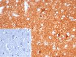 NSE gamma (Neuron Specific Enolase, gamma) (Neuroendocrine Marker) Antibody in Immunohistochemistry (Paraffin) (IHC (P))