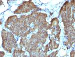 NSE gamma (Neuron Specific Enolase, gamma) (Neuroendocrine Marker) Antibody in Immunohistochemistry (Paraffin) (IHC (P))