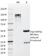 NSE gamma (Neuron Specific Enolase, gamma) (Neuroendocrine Marker) Antibody in SDS-PAGE (SDS-PAGE)