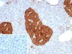 NSE gamma (Neuron Specific Enolase, gamma) (Neuroendocrine Marker) Antibody in Immunohistochemistry (Paraffin) (IHC (P))