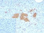 NSE gamma (Neuron Specific Enolase, gamma) (Neuroendocrine Marker) Antibody in Immunohistochemistry (Paraffin) (IHC (P))