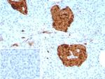 NSE gamma (Neuron Specific Enolase, gamma) (Neuroendocrine Marker) Antibody in Immunohistochemistry (Paraffin) (IHC (P))