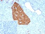 NSE gamma (Neuron Specific Enolase, gamma) (Neuroendocrine Marker) Antibody in Immunohistochemistry (Paraffin) (IHC (P))