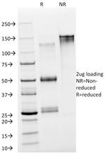 NSE gamma (Neuron Specific Enolase, gamma) Antibody in SDS-PAGE (SDS-PAGE)