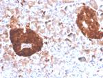 NSE gamma (Neuron Specific Enolase, gamma) (Neuroendocrine Marker) Antibody in Immunohistochemistry (Paraffin) (IHC (P))