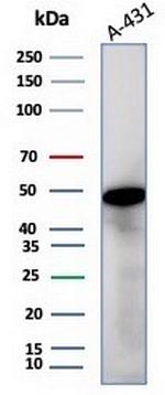 NSE gamma (Neuron Specific Enolase, gamma) (Neuroendocrine Marker) Antibody in Western Blot (WB)