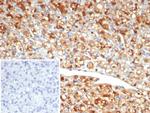 NSE gamma (Neuron Specific Enolase, gamma) (Neuroendocrine Marker) Antibody in Immunohistochemistry (Paraffin) (IHC (P))