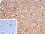 NSE gamma (Neuron Specific Enolase, gamma) (Neuroendocrine Marker) Antibody in Immunohistochemistry (Paraffin) (IHC (P))