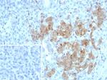 NSE gamma (Neuron Specific Enolase, gamma) (Neuroendocrine Marker) Antibody in Immunohistochemistry (Paraffin) (IHC (P))