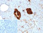 NSE gamma (Neuron Specific Enolase, gamma) (Neuroendocrine Marker) Antibody in Immunohistochemistry (Paraffin) (IHC (P))