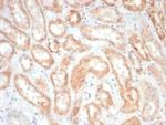 EPH Receptor B4 (EPHB4) Antibody in Immunohistochemistry (Paraffin) (IHC (P))