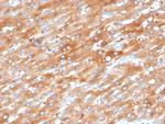 EPH Receptor B4 (EPHB4) Antibody in Immunohistochemistry (Paraffin) (IHC (P))