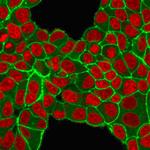 HER-2/c-erbB-2/neu/CD340 Antibody in Immunocytochemistry (ICC/IF)