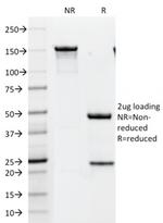 HER-2/c-erbB-2/neu/CD340 Antibody in SDS-PAGE (SDS-PAGE)