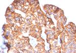 HER-2/c-erbB-2/neu/CD340 Antibody in Immunohistochemistry (Paraffin) (IHC (P))