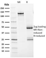 HER-2/c-erbB-2/neu/CD340 Antibody in SDS-PAGE (SDS-PAGE)