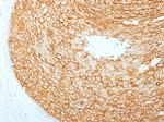 HER-2/c-erbB-2/neu/CD340 Antibody in Immunohistochemistry (Paraffin) (IHC (P))