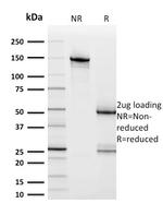 HER-2/c-erbB-2/neu/CD340 Antibody in SDS-PAGE (SDS-PAGE)