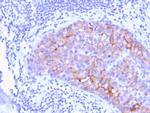 HER-2/c-erbB-2/neu/CD340 Antibody in Immunohistochemistry (Paraffin) (IHC (P))