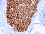 HER-2/c-erbB-2/neu/CD340 Antibody in Immunohistochemistry (Paraffin) (IHC (P))