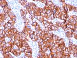 HER-2/c-erbB-2/neu/CD340 Antibody in Immunohistochemistry (Paraffin) (IHC (P))