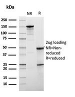 HER-2/c-erbB-2/neu/CD340 Antibody in SDS-PAGE (SDS-PAGE)