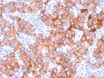 HER-2/c-erbB-2/neu/CD340 Antibody in Immunohistochemistry (Paraffin) (IHC (P))