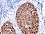 HER-2/c-erbB-2/neu/CD340 Antibody in Immunohistochemistry (Paraffin) (IHC (P))