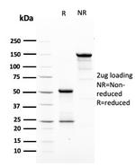 HER-2/c-erbB-2/neu/CD340 Antibody in SDS-PAGE (SDS-PAGE)