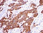 HER-2/c-erbB-2/neu/CD340 Antibody in Immunohistochemistry (Paraffin) (IHC (P))