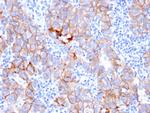 HER-2/c-erbB-2/neu/CD340 Antibody in Immunohistochemistry (Paraffin) (IHC (P))