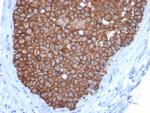 HER-2/c-erbB-2/neu/CD340 Antibody in Immunohistochemistry (Paraffin) (IHC (P))