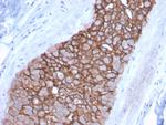 HER-2/c-erbB-2/neu/CD340 Antibody in Immunohistochemistry (Paraffin) (IHC (P))